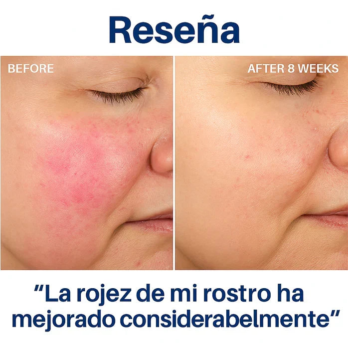 HYDROLUXE™ - Elimina el cloro y la cal de tu ducha